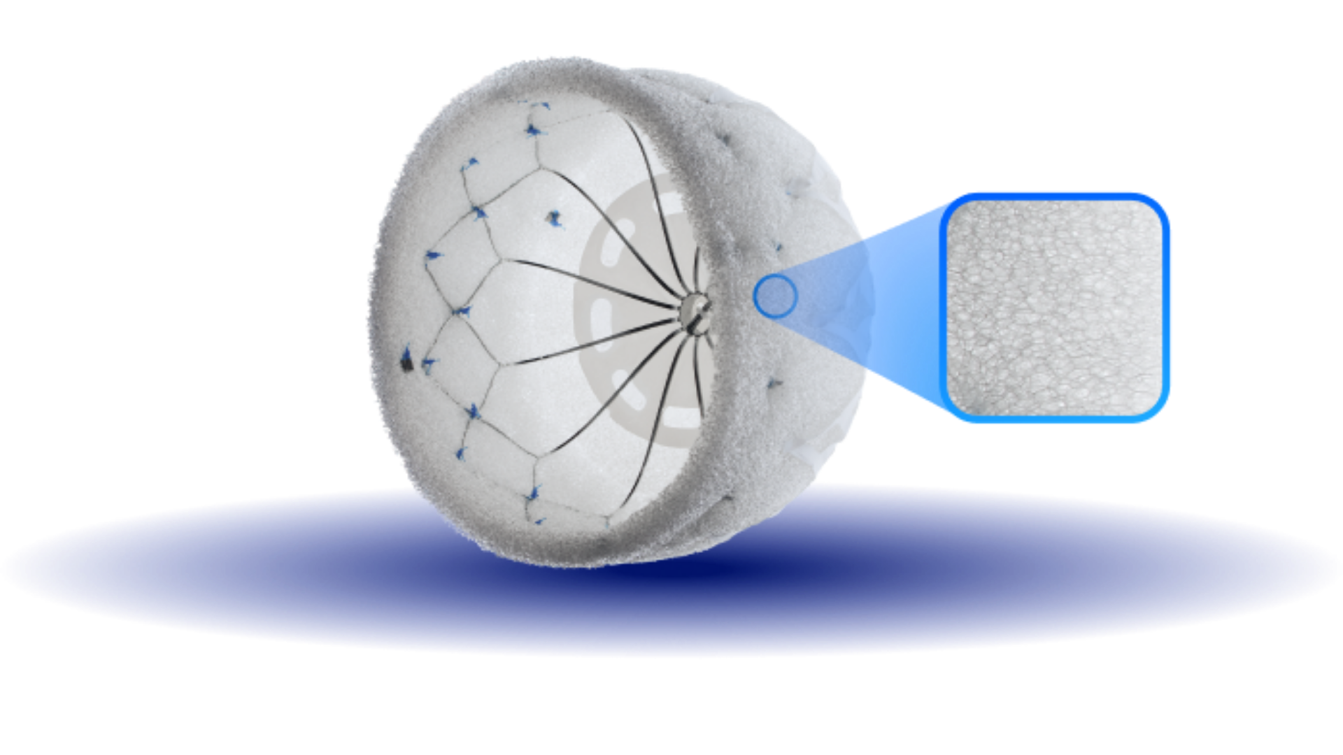 Conformal Medical cardiac device